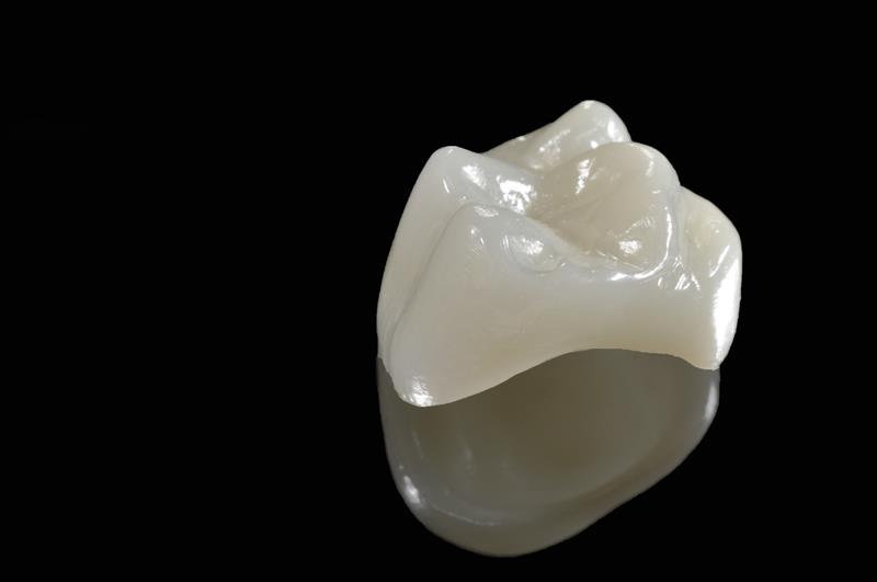 Porcelain Crowns  Charleston, SC 