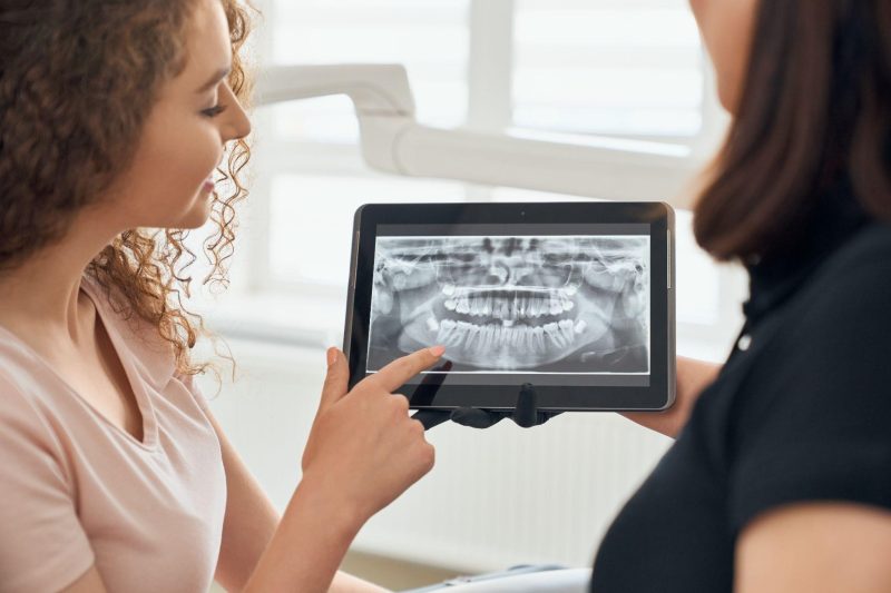 Digital Smile Design in James Island, SC