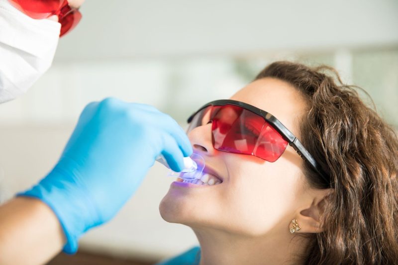 Laser Gum Contouring in James Island, SC